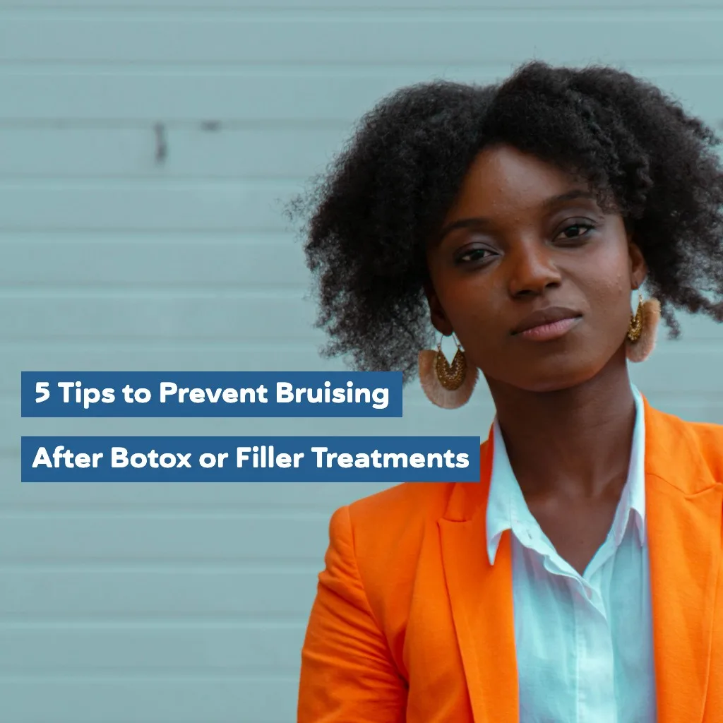 5 Tips To Prevent Bruising After Botox Or Filler Treatments 5 Tips To Prevent Bruising After Botox Or Filler Treatments 13843240