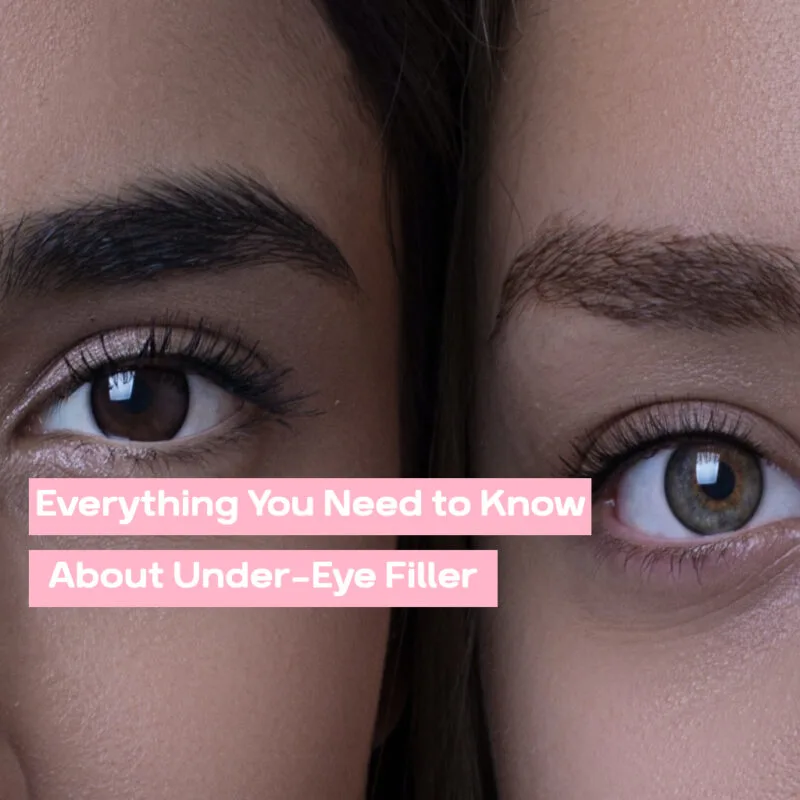 Everything You Need to Know About Under Eye Filler Everything You Need to Know About Under Eye Filler 37bafd75