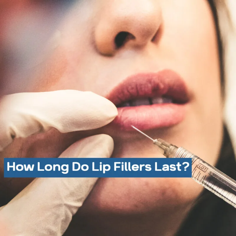 How Long Do Lip Fillers Last? How Long Do Lip Fillers Last fbc3a246